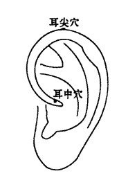 耳尖穴