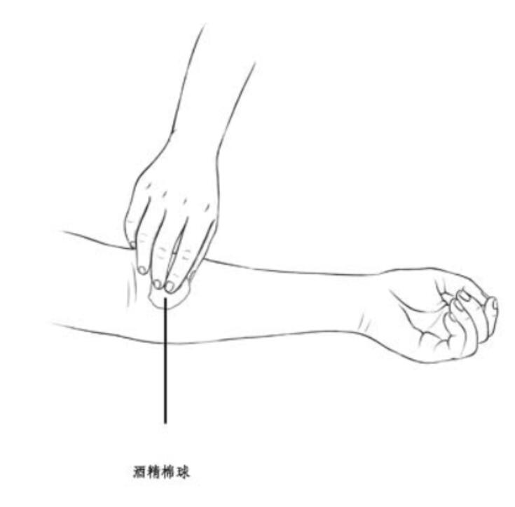 膝关节疼痛，从手肘上巧治