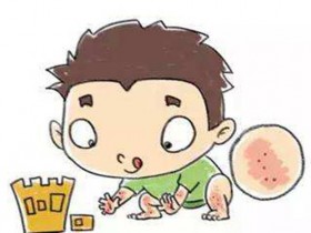 麻疹的起因和治疗,治疗小儿麻疹的食疗偏方