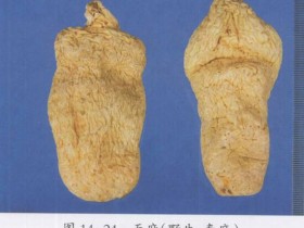 高血压的食疗偏方大全