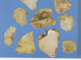 治疗咯血、吐血、肺虚咳嗽的药膳食疗方