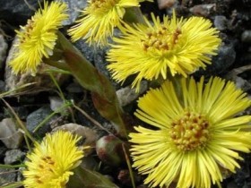 咳嗽的原因,春天咳嗽怎么办,春天咳嗽吃什么好的快