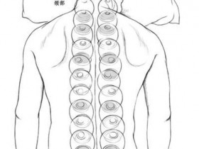 拔罐治疗中老年抑郁症