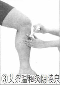 阴陵泉穴的艾灸方法