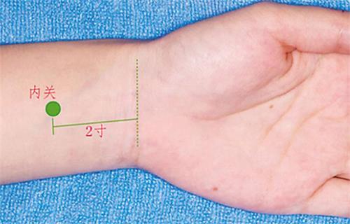 内关的准确定位图片