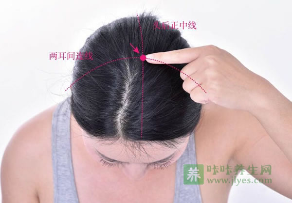 百会穴位位置图