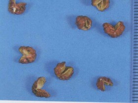 大建中汤组成,方歌方解,医案分析,功效与作用