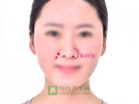 迎香穴的准确位置图,艾灸按摩迎香穴的作用及功效