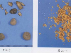 大风子的功效与作用及禁忌,中药大风子图片