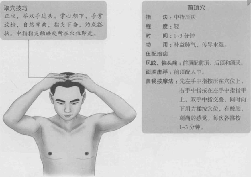 前顶的准确位置图