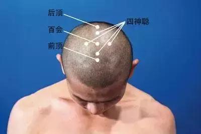 百会穴