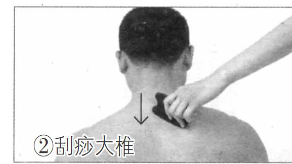 大椎穴的刮痧方法