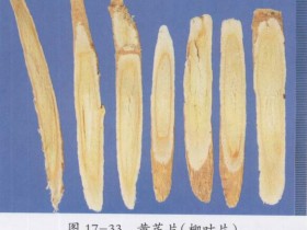 黄芪桂枝五物汤加减治疗血痹之症