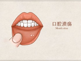 黄连上清丸的功效作用，什么情况下适合服用