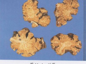 川芎的功效与作用及禁忌,中药川芎图片