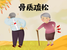 补肾抗衰系列谈—— 人老腿先老，骨骼衰老从35岁开始