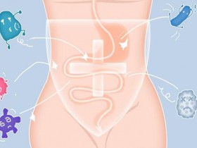 这几种情况需要补充成人益生菌，请注意！