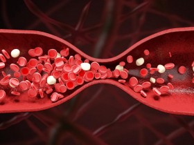 纳豆红曲的功效是什么？适合血脂偏高人群食用