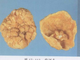 紫河车的功效与作用及禁忌,中药紫河车图片