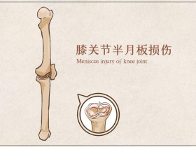 半月板受损吃氨糖有用吗？呵护关节健康少不了它！