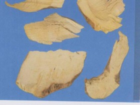 常山（蜀漆）的功效与作用,中药常山图片