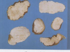 七叶一枝花的功效与作用,中药七叶一枝花(蚤休)图片