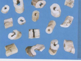 牡丹皮的功效与作用,牡丹皮的副作用及禁忌,中药丹皮图片