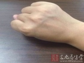 身体各部位青筋明显的原因