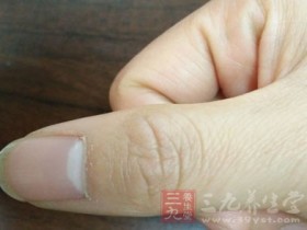 怎么从指甲月牙看健康,手指没有半月痕怎么补