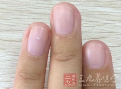 一般营养不良的人容易出现指甲苍白的情况