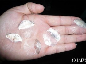 鱼痣怎么治,鱼痣的去除方法