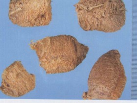 桑螵蛸散组成,方歌方解,医案分析,功效与作用