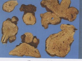 归脾汤组成,方歌方解,医案分析,功效与作用