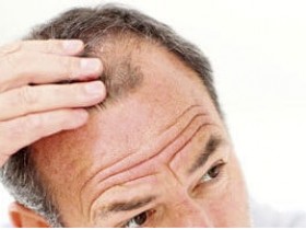 头发稀少掉发脱发怎么办,头发稀少怎么变浓密,头发稀少什么原因