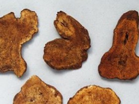 过敏性结肠炎的中医治疗医案