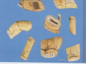 感冒挟湿的中医治疗医案一则