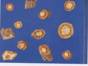 感冒中医辨证论治医案二则