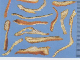 复元通气散加减治疗气滞腰痛