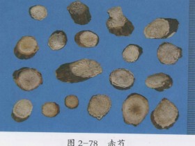 肾虚腰痛的中医治疗医案