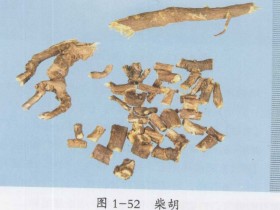 小柴胡汤加减治疗胆道蛔虫合并胰腺炎