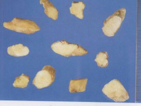 知柏地黄汤加味治疗肝肾阴亏，虚火上炽型头痛