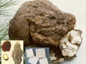 苏子降气汤加减治疗支气管炎久咳伤肺