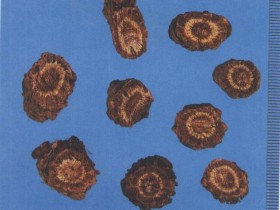 张氏选奇汤随证化裁治愈三阳头痛