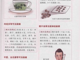 面瘫的中药治疗方法：半夏、全瓜蒌等配伍可治面瘫