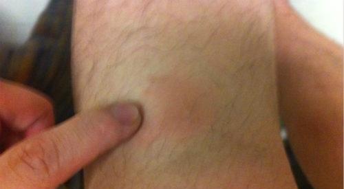 胫骨疼痛的偏方2