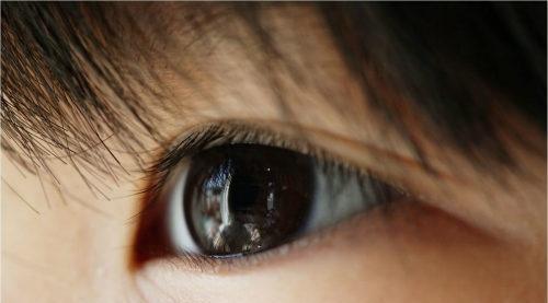 角膜病变的偏方2