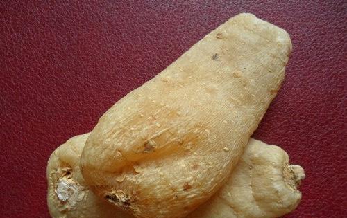 胶质细胞瘤的偏方 胶质细胞瘤的偏方