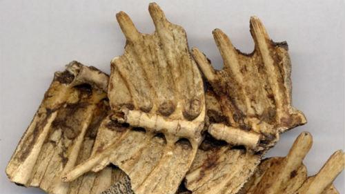 颅内肿瘤的偏方 颅内肿瘤的偏方