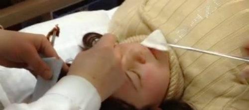 口眼歪斜的偏方2