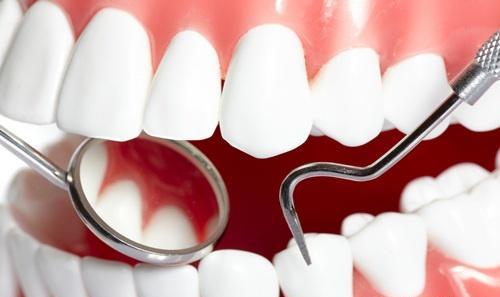 龋齿的偏方 龋齿的偏方